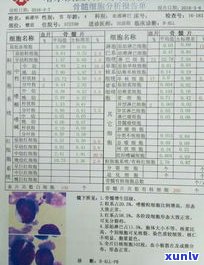 30岁负债几十万：仍有期望吗？女性在三十多岁时负债数十万是不是有可能翻身？