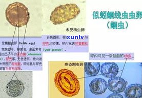 普洱茶里的虫子：种类、名称、生态及图片全解析