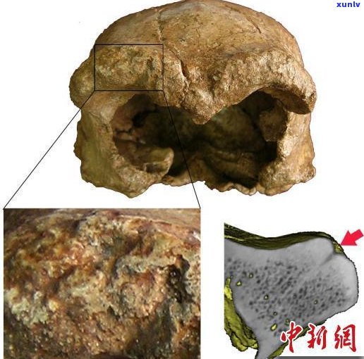 牛胃里的石头是什么？形状、种类及名称全揭秘