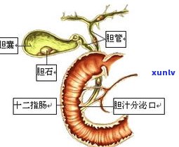 牛胃里面结石：类型、形状、病症及图片全解