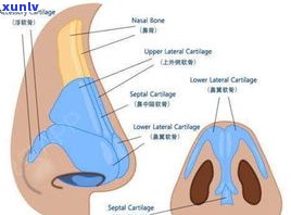 全面解析鼻托的材质种类及图片展示