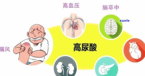 喝普洱茶真的能有效排宿便吗？探讨其科学原理与适用人群