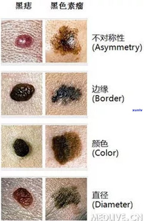 普洱茶好黑是不是加了色素？探讨黑色素含量与正常色泽的关系