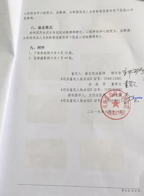 经侦传唤了3次后仍可能继续传唤，起因何在？已传唤多次仍未判决或拘留，这是为何？