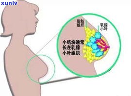 肝囊肿患者可以喝普洱茶吗？女性、能喝吗？相关问题解答