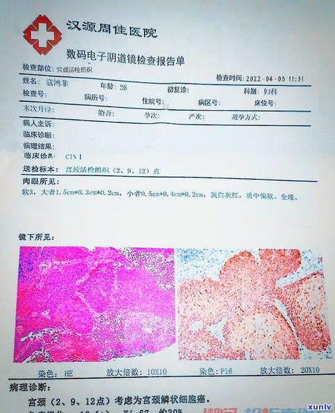 浦发信用卡延期三天如何计算？利息、还款方式全解！