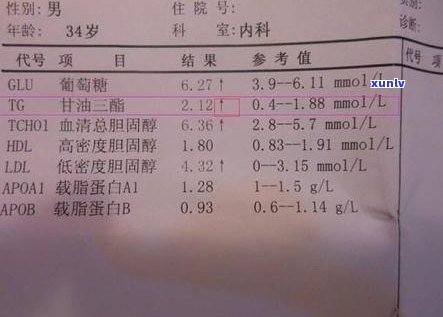 普洱熟茶降血脂效果真好：实验证明其有效降低血脂，适合高血脂人群饮用。