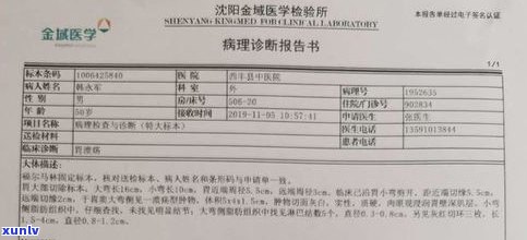 停息挂账可以提前结清吗？银行怎样解决信用卡、银行卡及贷款申请？